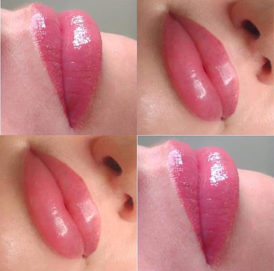 DUDAK RENKLENDİRME (MİKROPİGMENTASYON)