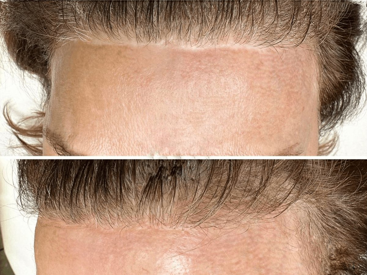 KAMUFLAJ MAKYAJ KURSU 